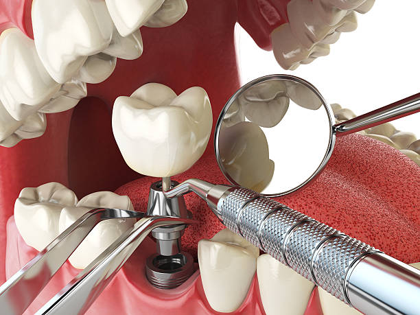 Best Knocked-Out Tooth Emergency  in Thomasville, NC