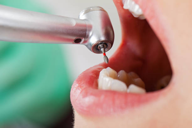 Best Cracked Tooth Emergency Dentist  in Thomasville, NC